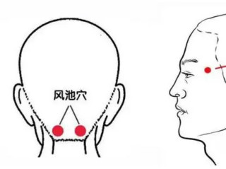 艾灸防治偏头痛